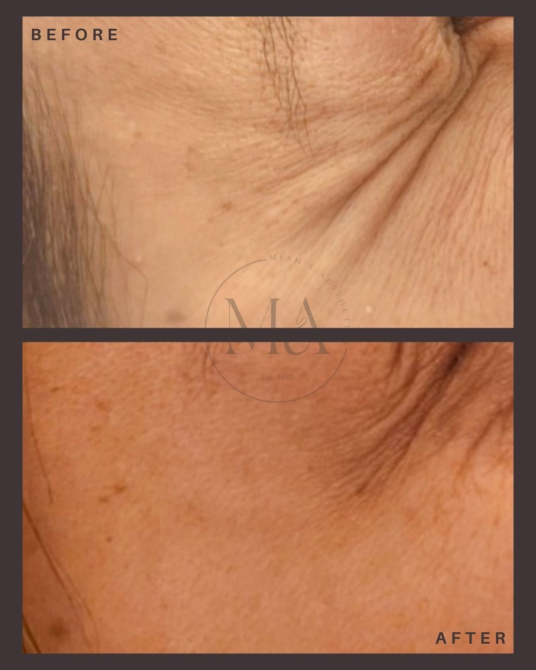 Facial Aesthetics Eastbourne