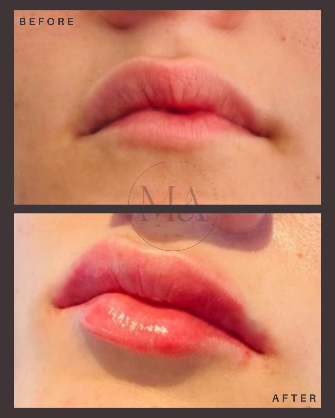 Facial Aesthetics Eastbourne